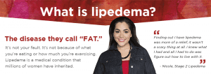 what is lipedema