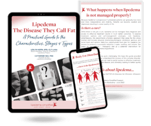 A Practical Guide to the Characteristics, Stages, and Types of Lipedema and Lymphedema