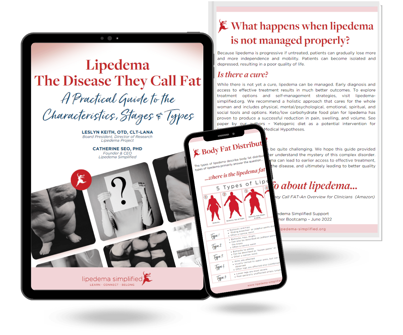 A Practical Guide to the Characteristics, Stages, and Types of Lipedema and Lymphedema