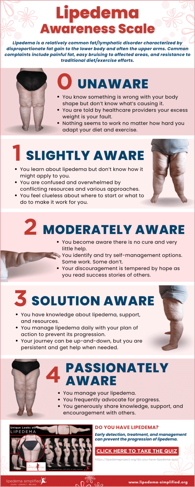 Is It Lipedema or Just Fat? Understanding Lipedema and Its Stages